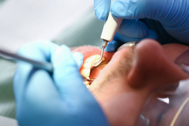 Best Emergency Denture Repair in Bear Rocks, PA